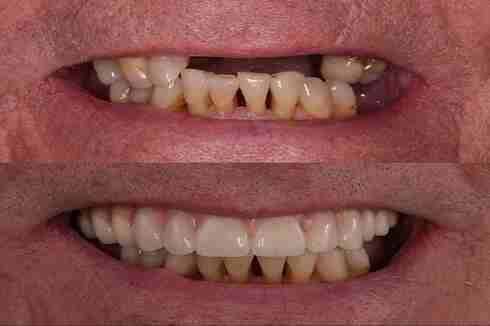 Image Source -Directory dental Manchester