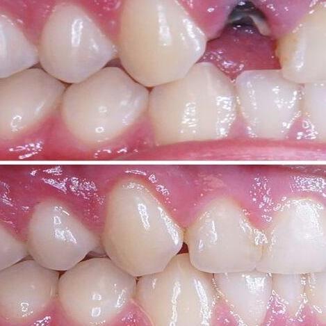 Dental Implantsedinburgh