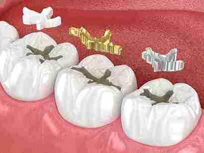 Image Source -Directory dental Manchester